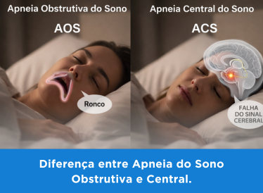 Diferença entre Apneia do Sono Obstrutiva e Central 